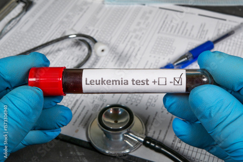 Doctor holding blood sample for leukemia test: negative result