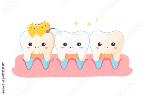 Cute cartoon teeth with dental filling and polishing process showing dental care and hygiene