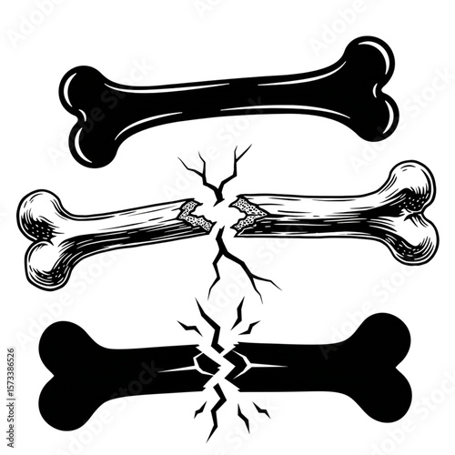 Three bones presented in different states, ideal for healthcare designs and veterinary themed projects featuring skeletal remains.