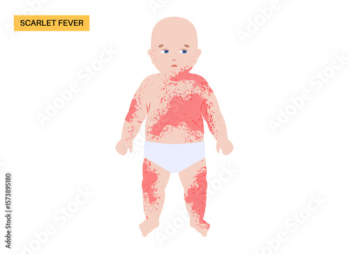 Scarlet fever poster.