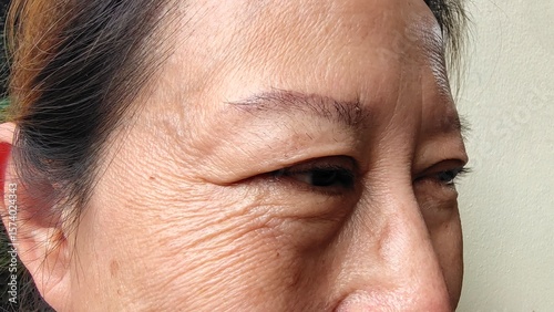 Фотография close up of a woman looking up, Flabby skin and creases, swelling and ptosis beside her eye, dark spots and blemish, freckles and scar on the face, health care and beauty concept