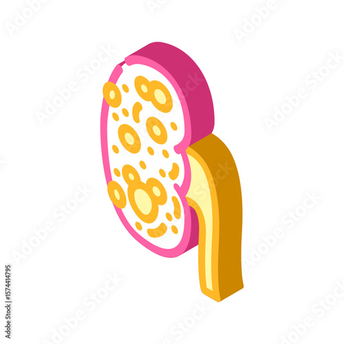 polycystic kidney disease isometric icon vector illustration