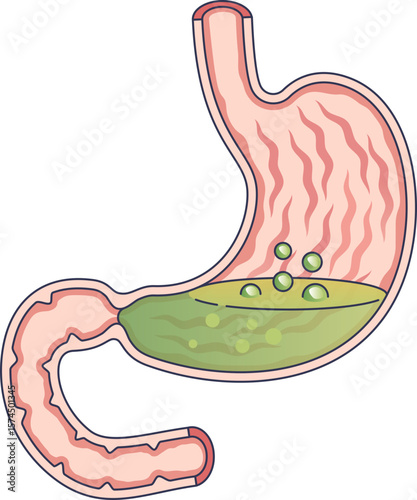 Anatomical illustration of a human stomach cross-section with gastric acid and bubbles. This represents digestion, acid reflux, heartburn, and other digestive issues.
