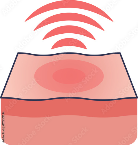 A medical illustration of inflamed tissue. A cross-section shows a red, swollen area on the skin, with pain or heat signals radiating outwards, symbolizing an inflammatory response.