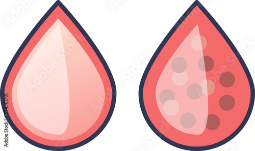 Two stylized blood drops. One is clear, representing healthy blood. The other contains particles, symbolizing impurities, blood cells, or a blood disorder like thrombosis or anemia.
