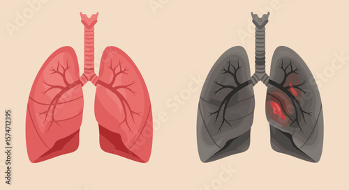 Lungs illustration showing healthy red lungs and unhealthy black lungs  for anti-smoking campaigns and respiratory health education