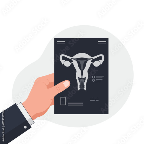 Hand holding medical report with uterus diagram in black background  