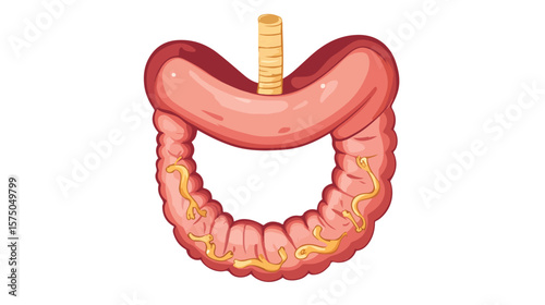 Detailed Cartoon Illustration of Human Stomach with Helicobacter Pylori Bacteria, Medical Education Concept