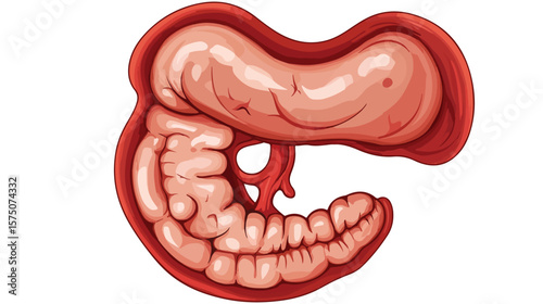 Human Stomach Ulcer Cartoon Design - Detailed Human Anatomy Illustration