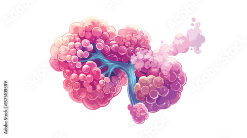 Human Alveoli with Pneumonia Cartoon Design