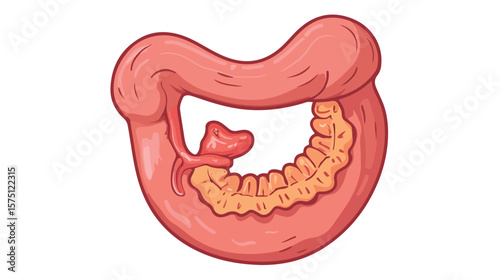 Detailed Cartoon Illustration of Human Stomach with Helicobacter Pylori Bacteria, Medical Education Concept