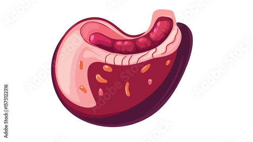 Human Stomach Ulcer Cartoon Design - Detailed Human Anatomy Illustration