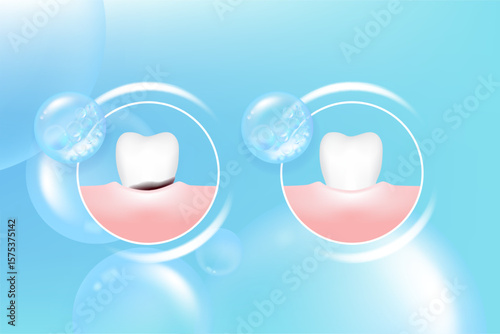 Teeth and gum care solutions ad, blue collagen with cosmetic advertising background ready to use, illustration vector.