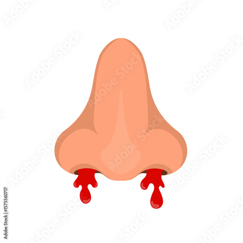 vector illustration of a bleeding nose, bleeding from the nose on a white background