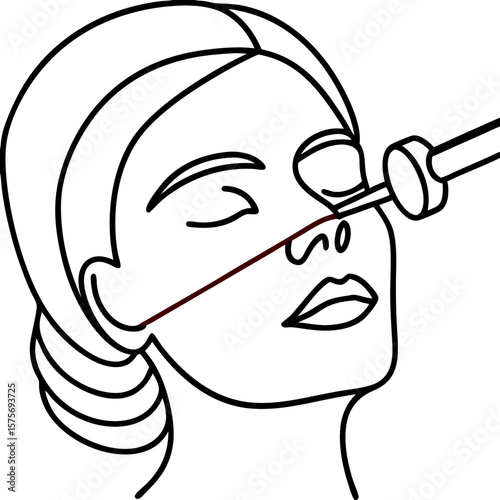 Laser beam lifting facial contour being performed on patient, showing fine line work and medical device. Laser beam lifting facial contour application requires precision and expertise.