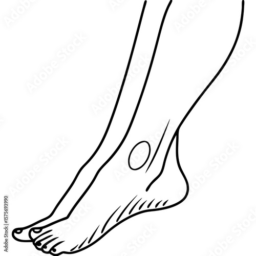 Leg skin with highlighted spot showing a problem area on human leg. Medical leg skin illustration showing a potential issue. Ideal leg skin with highlighted spot for dermatology,