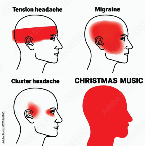 Types of Headaches and Pain Locations Infographic – Migraine, Tension, Cluster, Visual Guide