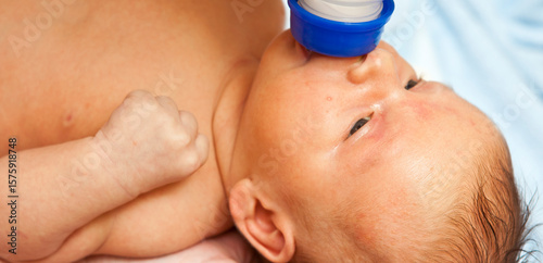 Newborn baby with jaundice sucks formula. Close-up portrait