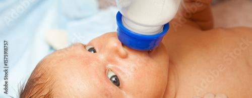 Newborn baby with jaundice sucks formula. Close-up portrait