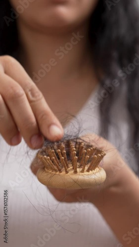 Woman with hair loss dryness and frizziness	