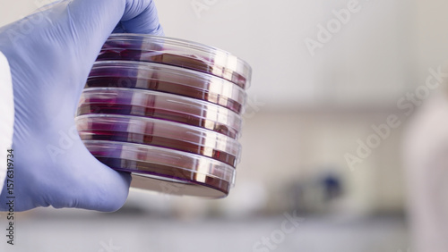 Slika na platnu A stack of Petri dishes with red ENDO medium in a scientist's hand, close-up