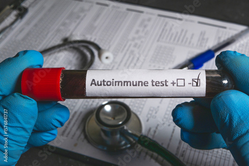 Doctor holding autoimmune blood test tube with negative result