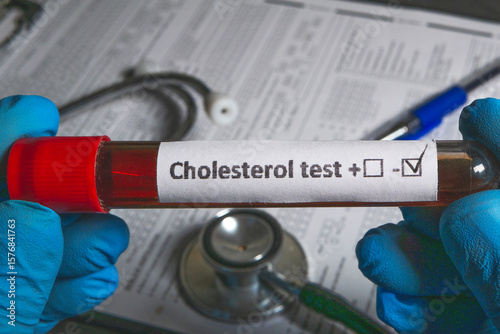 Doctor holding cholesterol blood test sample with positive result