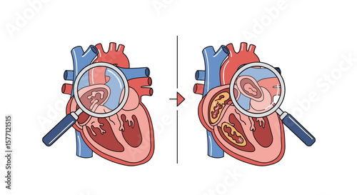 Understanding heart valve function and potential issues through magnified views