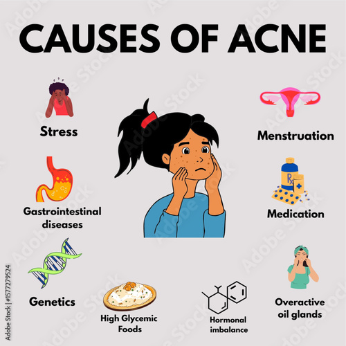causes of acne pimples female women problem infographic representation.eps