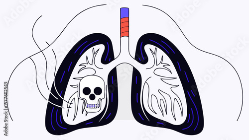 Damaged Lungs Illustration Showing Effects of Smoking or Pollution Vector