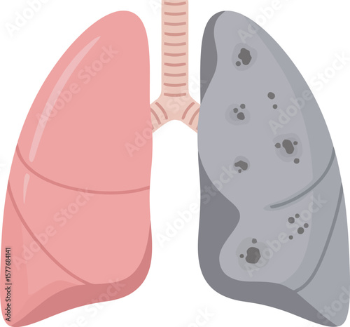 Healthy and diseased lungs comparison; illustrating the effects of damage on lung tissue.