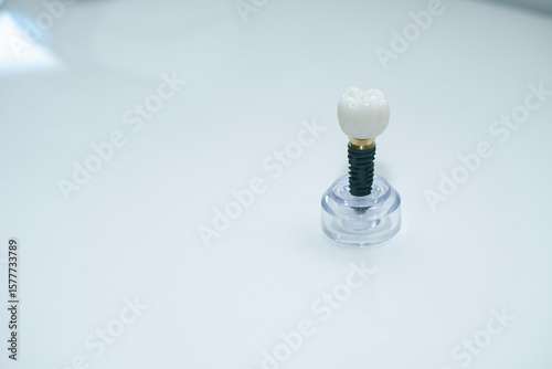 Model of dental implant on stand on white background