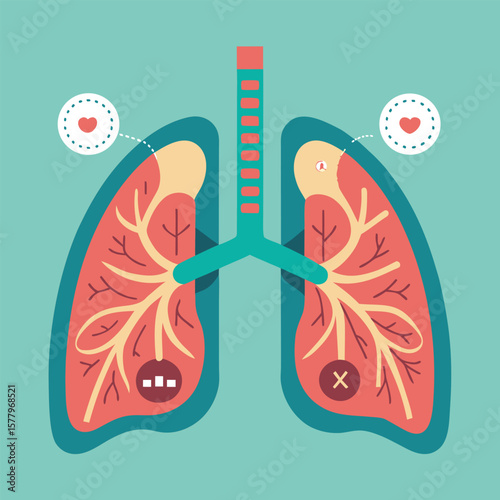 A stylized depiction of healthy and unhealthy lungs featuring elements related to health and disease.