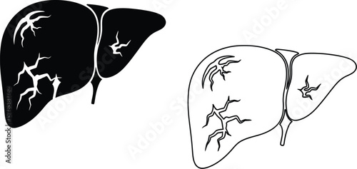 Liver health illustration: medical diagram for liver disease, anatomy, and hepatitis awareness design