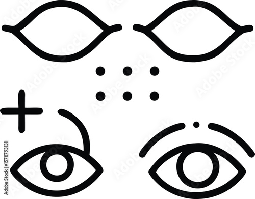 Outline Illustration Showing Before and After Eyelid Surgery with Double Eyelid Creation and Epicanthoplasty Asian Eye Surgery Concept