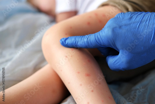 Konstfotografi Doctor examining child with bodily red rash