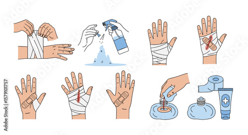 First aid steps for hand injuries wound care and bandaging techniques