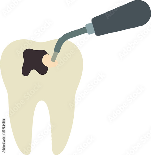 Flat vector molar with caries and filling tool applying composite material, isolated on white