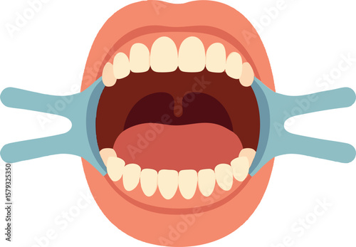 Flat vector open mouth with dental retractor during examination, flat style, isolated on white