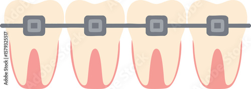 Flat vector orthodontic braces on teeth with wire and brackets, close-up, isolated on white