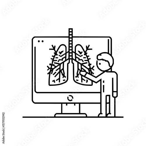 A doctor pointing at lungs on a computer screen, showing lung analysis and medical examination results
