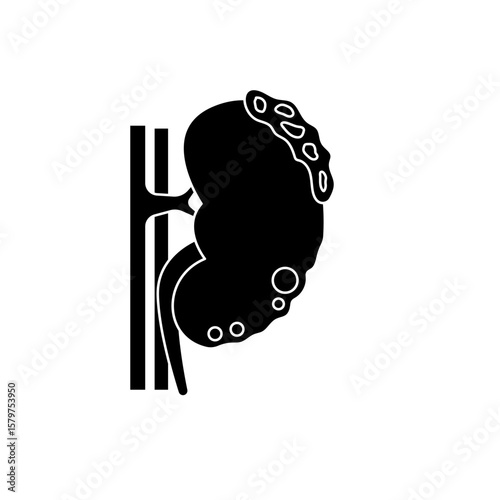 chronic kidney disease