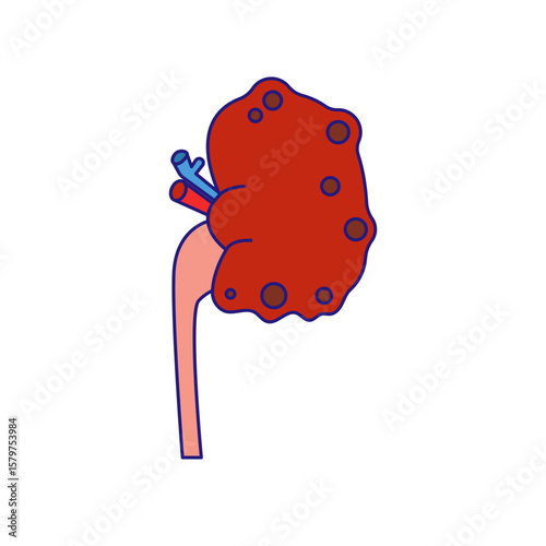 chronic kidney disease