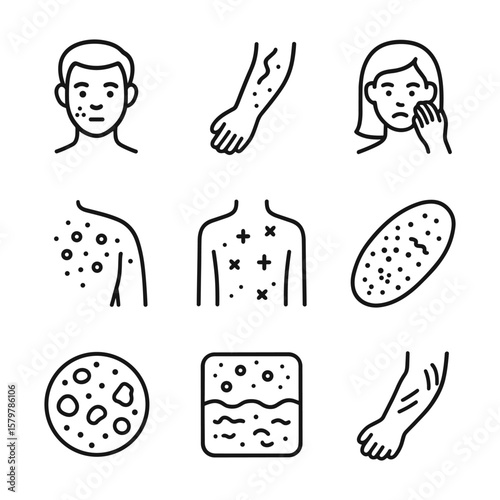 Clinical skin condition medical icons. Outline symbols. Line design