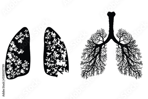 variety of lung anatomy silhouette illustrations in black, featuring bronchi and alveoli detail on white background
