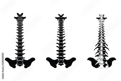 spinal screw silhouette illustrations in black, used in orthopedic and spine surgery