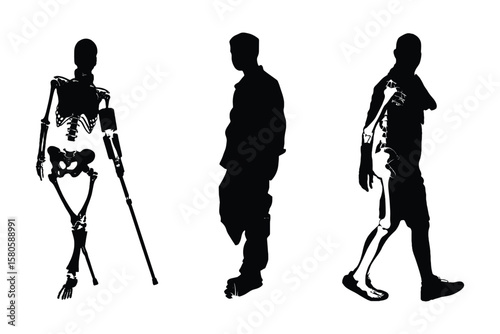 silhouette illustrations of human figures walking with leg prosthetics and walking aids