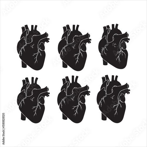 Six black human hearts displaying coronary artery blockages and blood flow