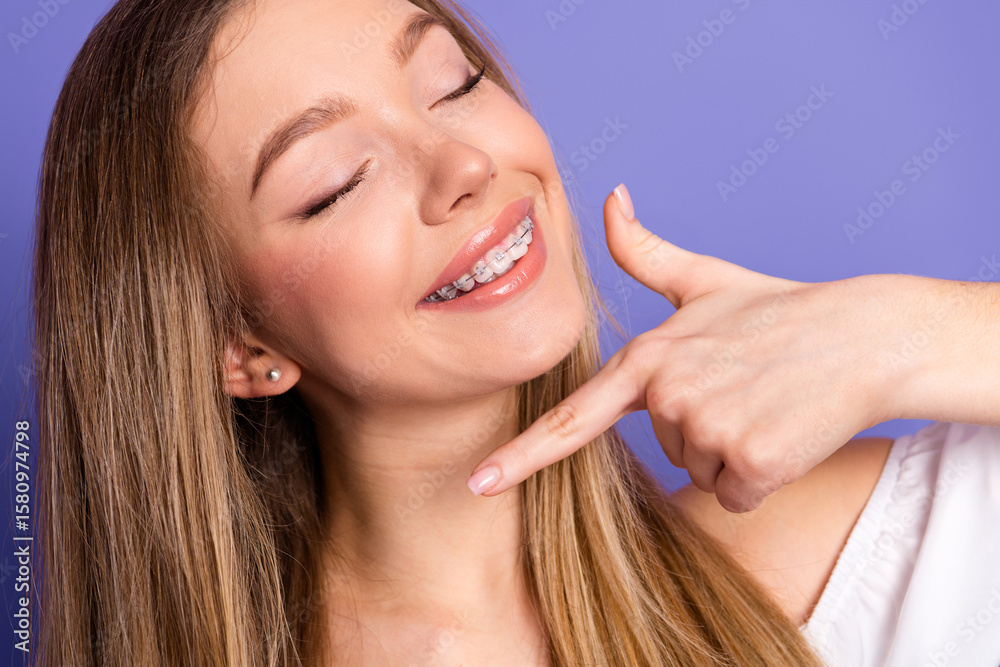 Smiling young woman with braces pointing at her teeth against a vibrant purple background showcasing confidence and beauty Smiling young woman with braces pointing at her teeth against a vibrant purple background showcasing confidence and beauty