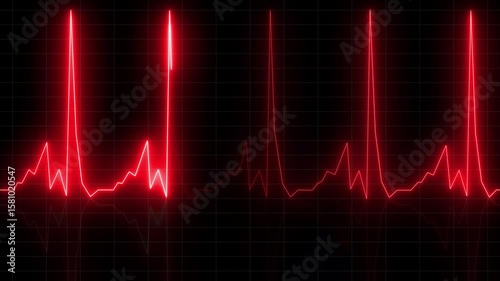 Abstract heartbeat and pulse rate signal technology , Electrocardiogram show heart beat line icon animated  on grid background. 